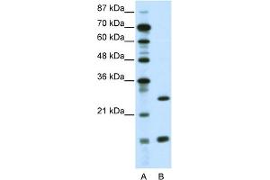 WB Suggested Anti-CEBPG Antibody Titration:  0. (CEBPG antibody  (N-Term))