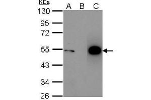 Immunoprecipitation (IP) image for anti-Tumor Protein P53 (TP53) (N-Term) antibody (ABIN2854816)