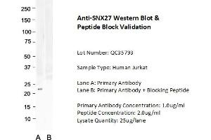 Host: Rabbit Target Name: SNX27 Sample Type: Human Jurkat  Lane A: Primary Antibody  Lane B: Primary Antibody + Blocking Peptide  Primary Antibody Concentration: 1.