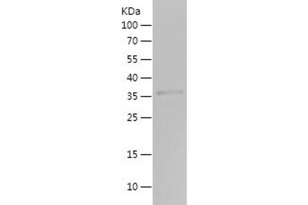 MMP20 Protein (AA 174-294) (His-IF2DI Tag)