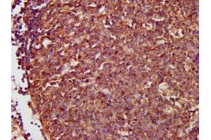 IHC image of ABIN7161781 diluted at 1:500 and staining in paraffin-embedded human lymph node tissue performed on a Leica BondTM system.