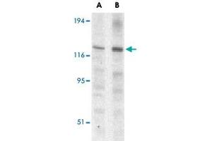 Western blot analysis of Casp12 (small) in mouse (lane A) and rat (lane B) liver lysate with Casp12 small polyclonal antibody  at 1 ug/mL .