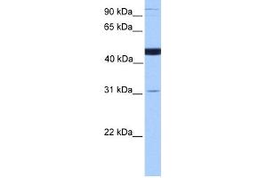 WB Suggested Anti-SCCPDH Antibody Titration: 0. (SCCPDH antibody  (C-Term))