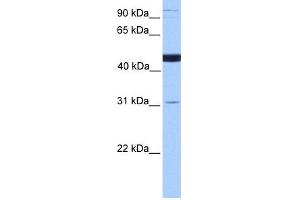 WB Suggested Anti-SCCPDH Antibody Titration: 0. (SCCPDH antibody  (C-Term))