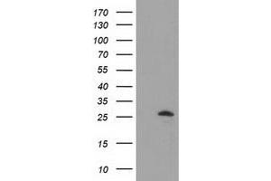 HEK293T cells were transfected with the pCMV6-ENTRY control (Left lane) or pCMV6-ENTRY AK3 (Right lane) cDNA for 48 hrs and lysed. (Adenylate Kinase 3 antibody)