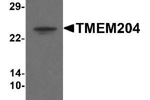 Western blot analysis of TMEM204 in human brain tissue lysate with TMEM204 antibody at 1 µg/mL .
