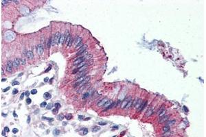 Human Colon (formalin-fixed, paraffin-embedded) stained with TJP3 antibody ABIN364296 at 10 ug/ml followed by biotinylated goat anti-rabbit IgG secondary antibody ABIN481713, alkaline phosphatase-streptavidin and chromogen. (TJP3 antibody  (C-Term))
