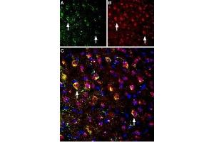 Multiplex staining of NMDAR1 and M4 muscarinic acetylcholine receptor in mouse parietal cortex - Immunohistochemical staining of immersion-fixed, free floating mouse brain frozen sections using rabbit Anti-CHRM4 Antibody (ABIN7043064, ABIN7044584 and ABIN7044585), (1:400) and Guinea pig Anti-NMDAR1 (GluN1) (extracellular) Antibody (ABIN7043243, ABIN7045402 and ABIN7045403), (1:1200). (GRIN1/NMDAR1 antibody  (Extracellular))