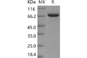 Western Blotting (WB) image for Lactotransferrin (LTF) protein (His tag) (ABIN7320159) (Lactoferrin Protein (His tag))