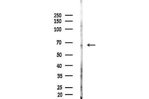 anti-Glutamate Decarboxylase 1 (Brain, 67kDa) (GAD1) (C-Term) antibody