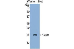 Western Blotting (WB) image for anti-Endoglin (ENG) (AA 336-450) antibody (ABIN1174025) (Endoglin antibody  (AA 336-450))