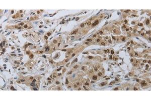 Immunohistochemistry (Paraffin-embedded Sections) (IHC (p)) image for anti-Protein Kinase, CAMP-Dependent, Regulatory, Type I, beta (PRKAR1B) antibody (ABIN7238306)