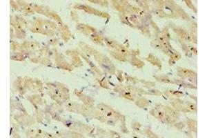 Immunohistochemistry of paraffin-embedded human heart tissue using ABIN7144868 at dilution of 1:100 (ATP5O antibody  (AA 24-213))