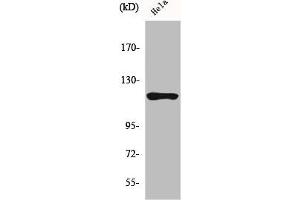 Western Blot analysis of HeLa cells using HXK I Polyclonal Antibody (Hexokinase 1 antibody  (N-Term))