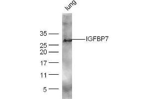 Mouse lung lysates probed with Rabbit Anti-IGFBP7 Polyclonal Antibody, Unconjugated  at 1:500 for 90 min at 37˚C.