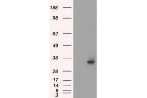 Western Blotting (WB) image for anti-Serine Racemase (SRR) antibody (ABIN1501137) (SRR antibody)