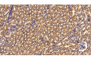 Immunohistochemistry (IHC) image for anti-Fibroblast Growth Factor Receptor 1 (FGFR1) (AA 236-362) antibody (ABIN7434056)