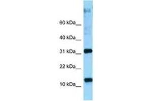 Image no. 1 for anti-Ribosomal Protein L22 (RPL22) (AA 73-122) antibody (ABIN6748251) (RPL22 antibody  (AA 73-122))
