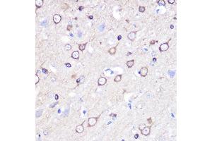 Immunohistochemistry of paraffin-embedded rat brain using Stathmin 1 Rabbit pAb (ABIN3023126, ABIN3023127, ABIN3023128 and ABIN6219402) at dilution of 1:100 (40x lens). (Stathmin 1 antibody  (AA 1-149))