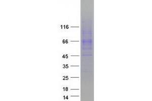 Validation with Western Blot (SLC6A4 Protein (Myc-DYKDDDDK Tag))
