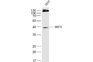 293T lysates probed with SKP2 Polyclonal Antibody, Unconjugated  at 1:500 dilution and 4˚C overnight incubation. (SKP2 antibody  (AA 351-424))