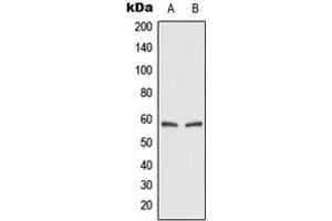 Western blot analysis of GLUT2 expression in HEK293T (A), rat kidney (B) whole cell lysates. (SLC2A2 antibody  (Center))