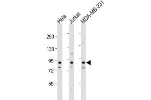 Western Blot at 1:1000 dilution Lane 1: Hela whole cell lysate Lane 2: Jurkat whole cell lysate Lane 3: MDA-MB-231 whole cell lysate Lysates/proteins at 20 ug per lane.
