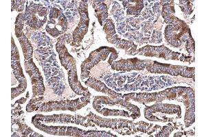 Immunohistochemistry (IHC) image for anti-NADH Dehydrogenase (Ubiquinone) Fe-S Protein 3, 30kDa (NADH-Coenzyme Q Reductase) (NDUFS3) (Center) antibody (ABIN2856200)