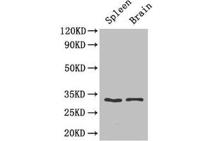 Western blot analysis of mouse spleen and mouse brain tissue, using Caspase 3 antibody (3 μg/ml) and Goat anti-Rabbit polyclonal secondary antibody (1/50000 dilution). (Caspase 3 antibody  (AA 29-175))