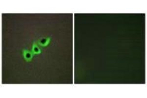 Immunofluorescence analysis of A549 cells, using RHG07 antibody. (DLC1 antibody)