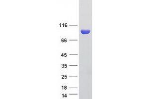 Western Blotting (WB) image for Ribonucleotide Reductase M1 (RRM1) protein (Myc-DYKDDDDK Tag) (ABIN2731206)