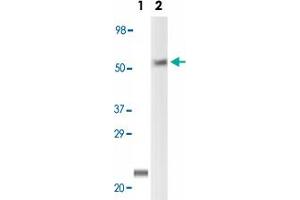 Western blot analysis using LCK monoclonal antibody, clone 8E5F9, 4B2C7  against truncated LCK recombinant protein (Lane 1) and Jurkat cell lysate (Lane 2).