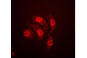Immunofluorescent analysis of ETS1 (pT38) staining in Jurkat cells. (ETS1 antibody  (N-Term, pSer38))
