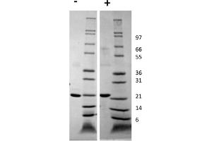SDS-PAGE of Human Growth Hormone Recombinant Protein SDS-PAGE of Human Growth Hormone Recombinant Protein.