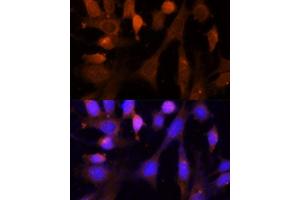 Immunofluorescence analysis of NIH-3T3 cells using VPS26A Polyclonal Antibody  at dilution of 1:100 (40x lens). (VPS26A antibody  (AA 208-327))