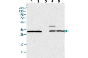 Western blot analysis of Lane 1: RT-4, Lane 2: U-251 MG, Lane 3: Human Plasma, Lane 4: Liver, Lane 5: Tonsil with UBE3D polyclonal antibody  at 1:250-1:500 dilution. (UBE3D antibody)