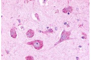 Anti-LPHN3 antibody  ABIN1049027 IHC staining of human brain, neurons. (LPHN3 antibody  (C-Term))