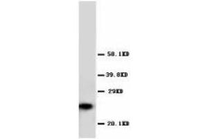 Image no. 1 for anti-Glutathione S-Transferase pi 1 (GSTP1) (AA 197-210) antibody (ABIN1493408) (GSTP1 antibody  (AA 197-210))