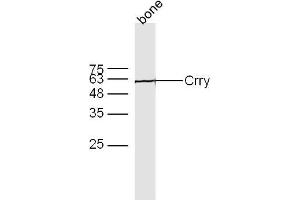 Bone lyates probed with Crry Polyclonal Antibody, Unconjugated  at 1:300 overnight at 4˚C.