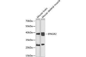 Western blot analysis of extracts of various cell lines, using IFNGR2 antibody (ABIN6134792, ABIN6142200, ABIN6142202 and ABIN6223464) at 1:1000 dilution. (IFNGR2 antibody  (C-Term))