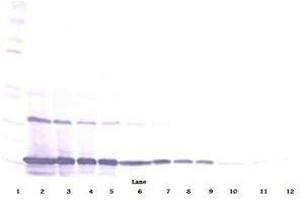 Image no. 2 for anti-Chemokine (C-C Motif) Ligand 2 (CCL2) antibody (ABIN465739) (CCL2 antibody)