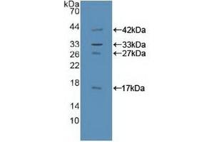 Detection of Recombinant GAB1, Human using Polyclonal Antibody to GRB2 Associated Binding Protein 1 (GAB1) (GAB1 antibody  (AA 394-656))