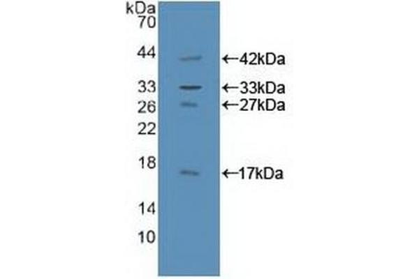 GAB1 anticorps  (AA 394-656)