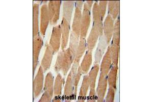COQ7 Antibody immunohistochemistry analysis in formalin fixed and paraffin embedded human skeletal muscle followed by peroxidase conjugation of the secondary antibody and DAB staining. (Coq7 antibody  (C-Term))