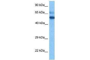 Host:  Rabbit  Target Name:  ESCO2  Sample Tissue:  Thymus Tumor lysates  Antibody Dilution:  1ug/ml (ESCO2 antibody  (Middle Region))