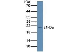 Detection of GKN3 in Rat Stomach Tissue using Polyclonal Antibody to Gastrokine 3 (GKN3) (Gastrokine 3 antibody  (AA 38-177))
