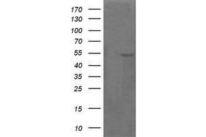 Image no. 2 for anti-Parvin, alpha (PARVA) antibody (ABIN1496445) (Parvin alpha antibody)