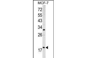 Western blot analysis of ARF3 antibody (Center D93) (ABIN390530 and ABIN2840877) in MCF-7 cell line lysates (35 μg/lane).