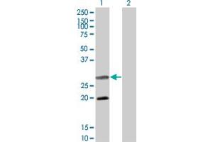 Western Blot analysis of DIABLO expression in transfected 293T cell line by DIABLO monoclonal antibody (M02), clone 4F9. (DIABLO antibody  (AA 119-218))