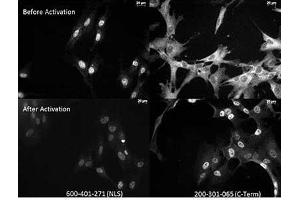 Anti NFkB monoclonal antibody – Immunocytochemistry Tissue: Human Fibroblasts Top: Before activation Bottom: After activation with poly IC Left: 600-401-271 anti p65 NLS specific lot 18372 Right:  Monoclonal antibody C-Term The two antibodies that are shown target different regions of the p65 protein. (NF-kB p65 antibody  (C-Term))